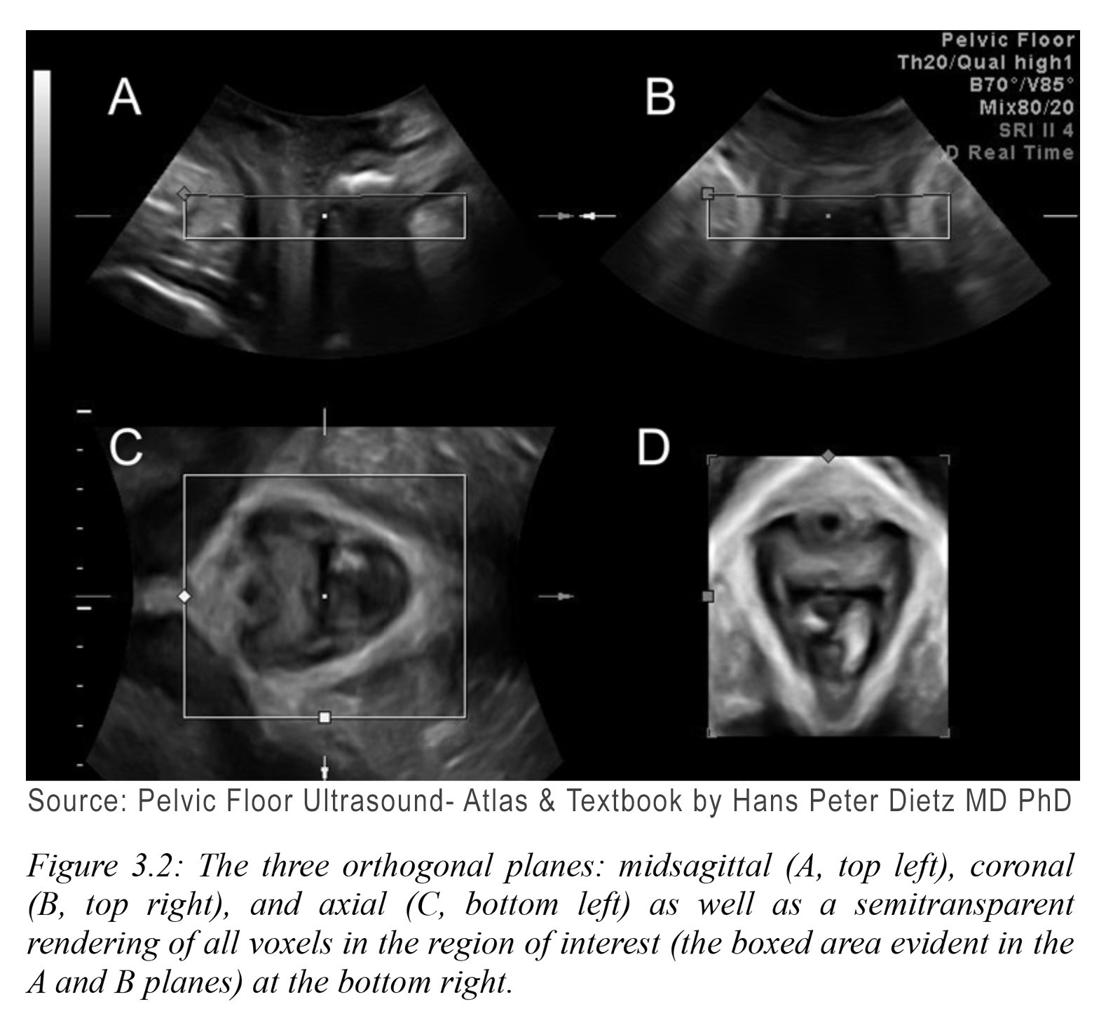 Digital Imaging for Pelvic Floor Disorders Imaging Technology News